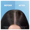 Head & Shoulders Apple Fresh 2az1-ben Sampon És Balzsam Az Akár 100%-os Korpamentességért termékhez kapcsolódó kép