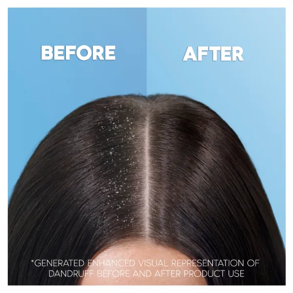 Head & Shoulders Apple Fresh 2az1-ben Sampon És Balzsam Az Akár 100%-os Korpamentességért termékhez kapcsolódó kép