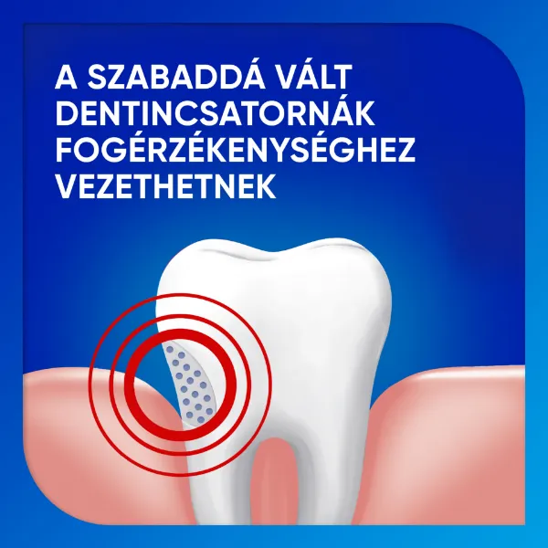 Sensodyne Fluoride fluoridos fogkrém 75 ml  termékhez kapcsolódó kép