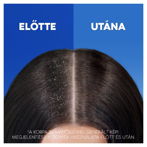 Head & Shoulders Citrus Fresh Korpásodás Elleni Sampon Az Akár 100%-os Korpamentességért, 900ml termékhez kapcsolódó kép