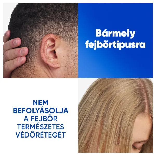 Head & Shoulders Apple Fresh korpa elleni sampon 250ml napi használatra bármely hajtípusra termékhez kapcsolódó kép