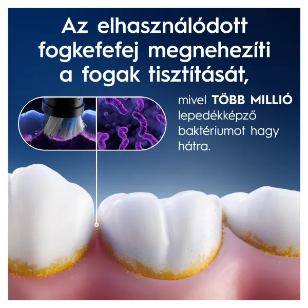 Oral-B iO Series Radiant White, Fekete, Eredeti Fogfehérítő Fogkefefej, 4 termékhez kapcsolódó kép