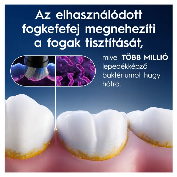 Oral-B iO Series Gentle Care, Fekete, Eredeti Fogkefefej, Érzékeny Fogínyhez, 4 termékhez kapcsolódó kép