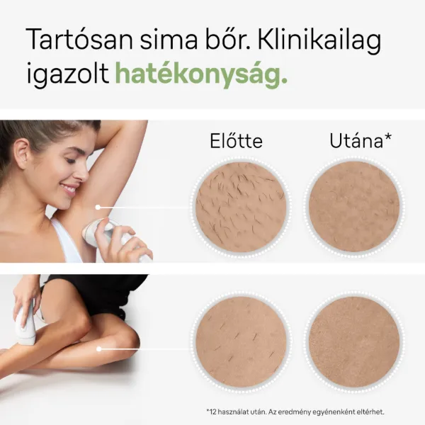 Braun IPL Silk expert Pro 3, Szőrtelenítés Otthoni Kezeléssel, Neszesszer, 2 Fej, PL3122 termékhez kapcsolódó kép