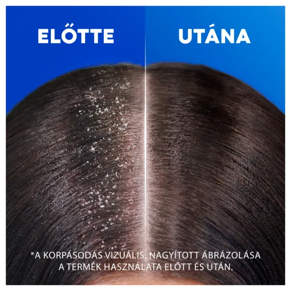 Head & Shoulders Apple Fresh korpásodás elleni sampon 800ml pumpás, napi használatra termékhez kapcsolódó kép