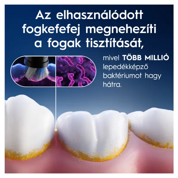 Oral-B iO Series Gentle Care, Eredeti Fogkefefej, Érzékeny Fogínyhez, 4 termékhez kapcsolódó kép
